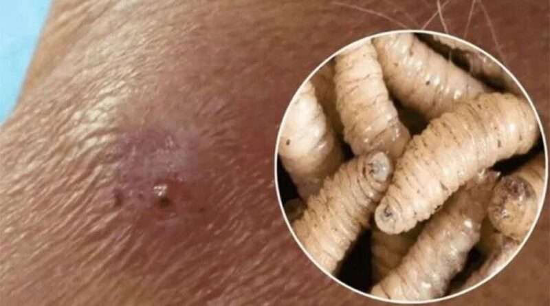 Veracruz concentra la mayor presencia territorial de miasis humana por gusano barrenador